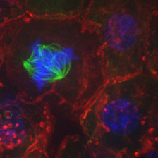 Hepatocytes with contrasting stains of mitotic spindle and chromosomes