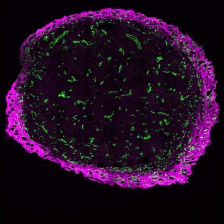 Mouse melanoma tumor slice with collagen-binder anchored to collagen 