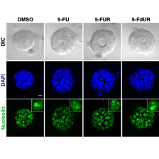 Three rows show a tumor responding to types of treatment. Columns are labeled “DMSO, 5-FU, 5-FUR, 5-FdUR.” Top shows grey microscopic image of tumor. Middle row is stained blue and shows blue lumps. Bottom row is stained green and shows smaller bits.