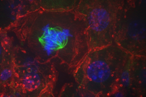 Hepatocytes with contrasting stains of mitotic spindle and chromosomes