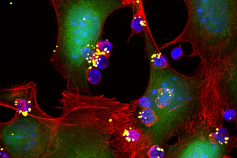 nanoparticles attached to T cells 