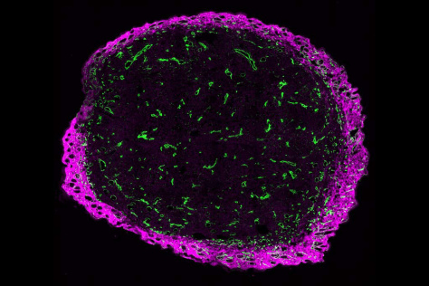 Mouse melanoma tumor slice with collagen-binder anchored to collagen 