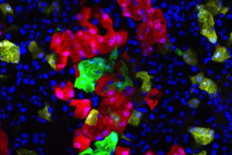 Mutated and nonmutated cells in a pancreas