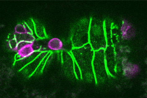 cell undergoing extrusion