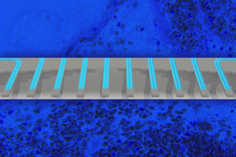 illustration of a suspended microchannel resonator