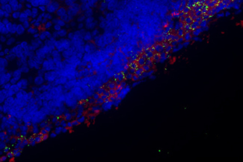 fluorescence image of tumor cells with probes along the edge