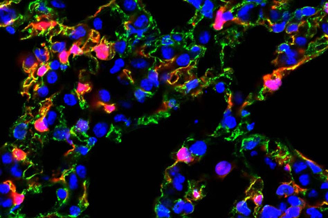 polymeric nanoparticles carrying mRNA to lung vasculature