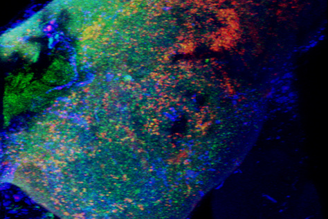 fluorescent labeled lymph node with T cells in red, B cells in green, lymph node cells in blue