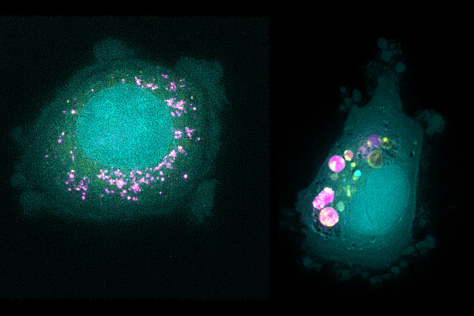 Two green blobs; the one on the left is surrounded by tiny pink dots, and the one on the right has larger pink and yellow clumps on next to it on one side