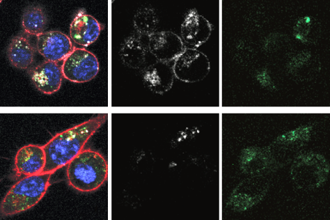 micrograph of cells with nanodiscs inside