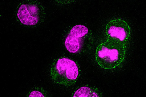 microscopic image of cells with DNA in magenta and lysosomal markers on surface in green