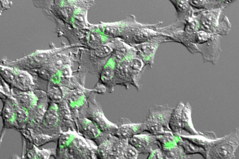 tumor cells expressing antigens (green)