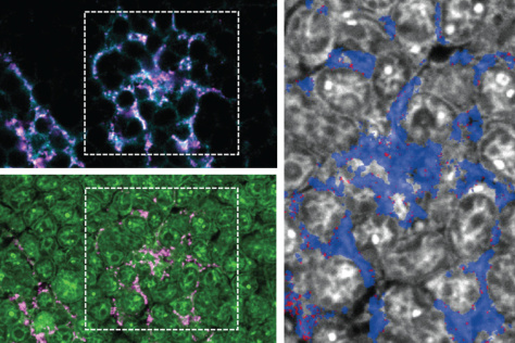 A mosaic of views of antigen localized to cells.