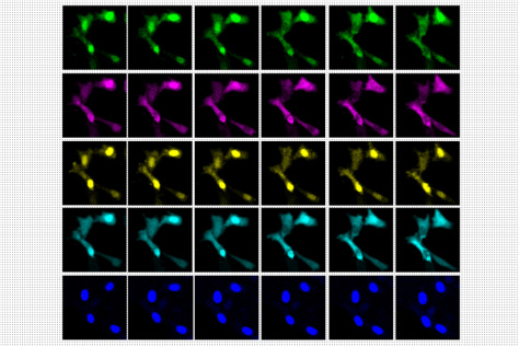 A 5 by 6 grid of micrographs of the same cell, each row a different color