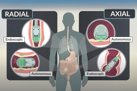 Various microjet devices showing radial and axial delivery methods for both endoscopic and autonomous devices.