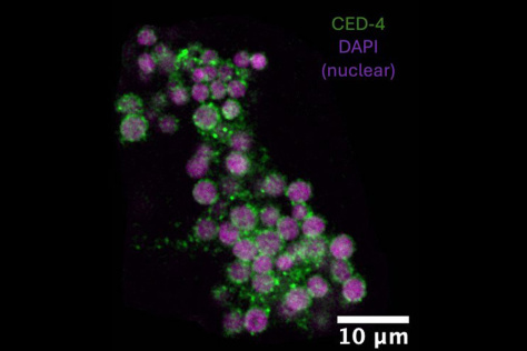 Nematode embryos appear as green and purple circles on a dark background.