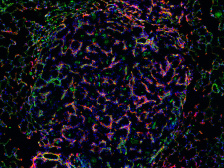 a web of fluorescent proteins against a black background